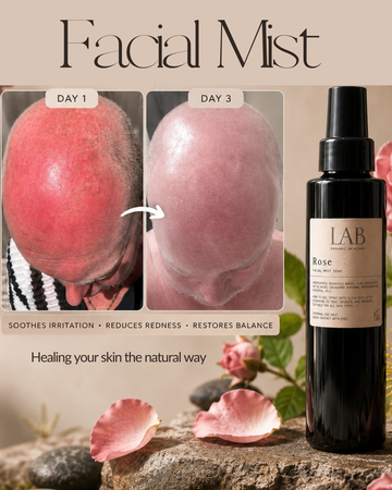 Rose Facial Mist