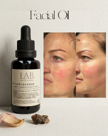 Frankincense Facial Oil